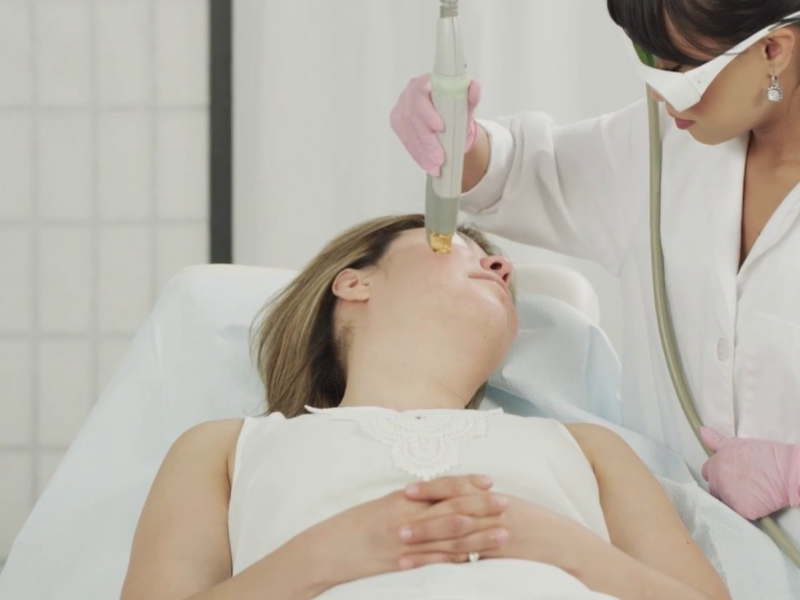 IPL Photo Rejuvenation Treatment Mummy Makeover Melbourne