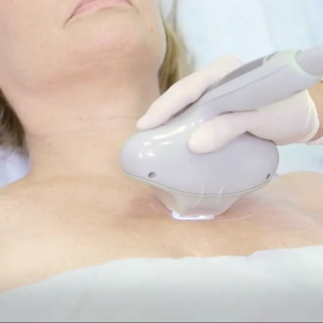 explanation laser skin rejuvenation