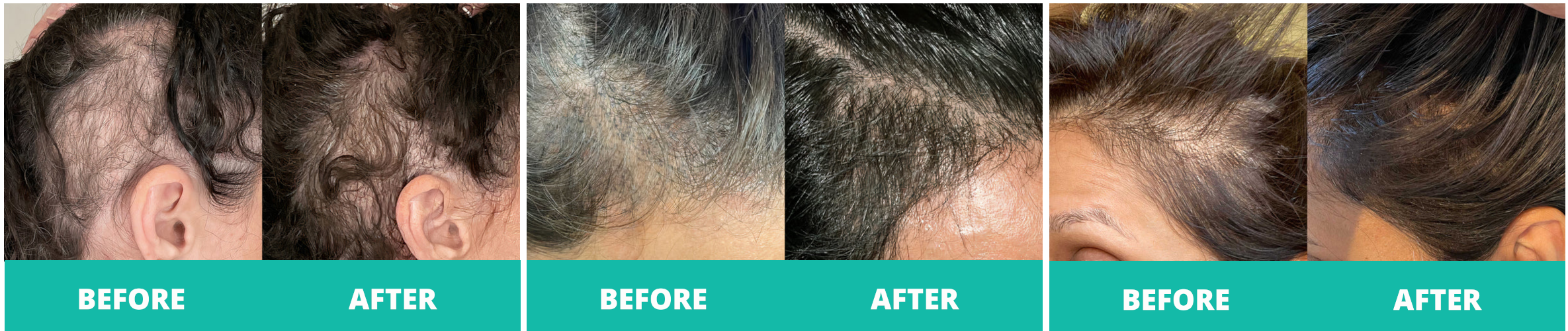 Before/After Women