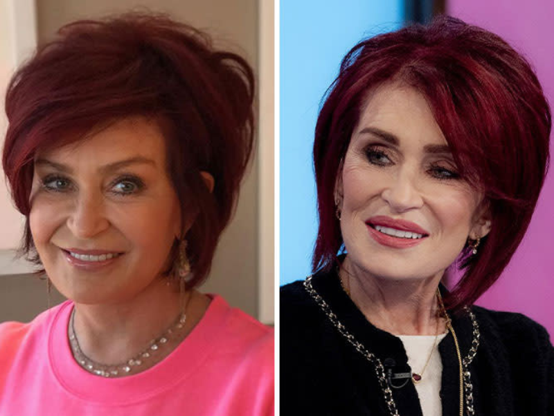 Ozempic Facial Volume Loss