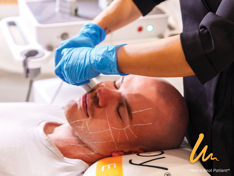 Ultherapy PRIME skin tightening for men’s jawline

non-surgical jawline tightening treatment for men

Ultherapy treatment supporting collagen for men