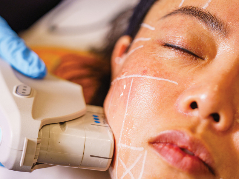 Doctor performing Ultherapy PRIME® skin tightening treatment on jawline at Dr T Aesthetics Melbourne